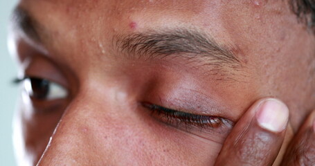 Tired man rubbbing eye with hand. Exhausted african american touching face