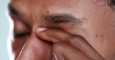 Fototapeta premium Man touching face rubbbing eye with finger and hand