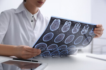 Doctor examining MRI images of patient with multiple sclerosis at table in clinic, closeup - Powered by Adobe