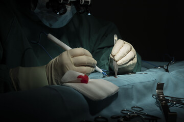 Female surgeon performs a micro-surgery operation on one arm.