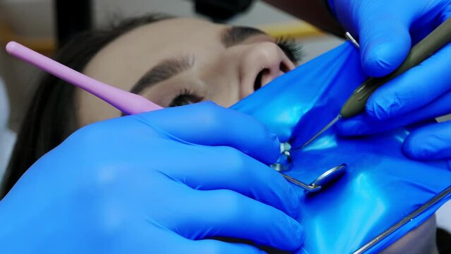 A dentist treats a woman's teeth using a cofferdam. Dental equipment.