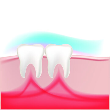 human teeth in the gum with tissues in the vector