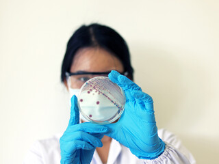 Researcher is holding Petri dish of Vibrio vulnificus in CHROMagar and TCBS, an estuarine bacterium which occurs in in filter-feeding molluscan shellfish, such as oysters., ingestion of the bacterium.