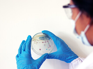 Researcher is holding Petri dish of Vibrio vulnificus in CHROMagar and TCBS, an estuarine bacterium which occurs in in filter-feeding molluscan shellfish, such as oysters., ingestion of the bacterium. - obrazy, fototapety, plakaty