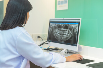 Obraz na płótnie Canvas Female dentist working with teeth x-ray on laptop in dental clinic, teeth check-up and Healthy teeth concept