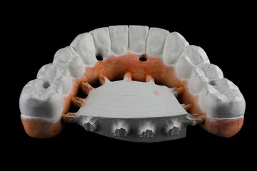 dental prosthesis made of zircon, view from the back to the anatomy of the teeth