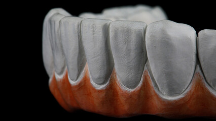 excellent macro photo of zircon teeth for the future creation of a lower jaw prosthesis on a black...