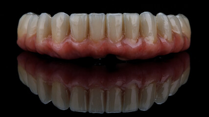 ceramic prosthesis with pink gum for the lower jaw, on black glass and creative reflection