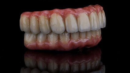 ceramic prostheses for the upper and lower jaws with pink gums in the bite, on black glass with reflection