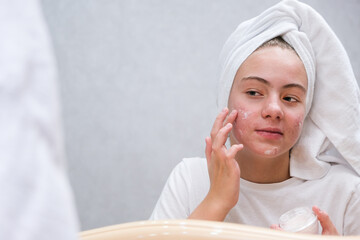 Acne. A teenage girl applying cream to the problematic skin