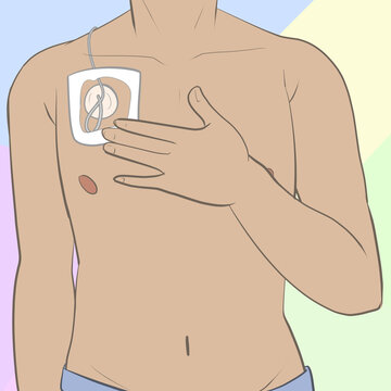 Chest IV Port