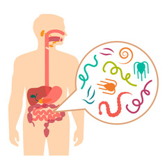 Vector Illustration of a Human Intestinal Parasites, worm disease