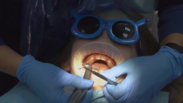 little girl with oral dilator at dentist's appointment. polishing of teeth