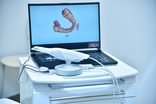 Dental intraoral 3d scanner and laptop on table