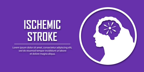 People suffering from ischemic stroke. Ischemic stroke patient concept. Medical help. People silhouette in paper cut style. Stroke types poster, banner. Medical vector illustration