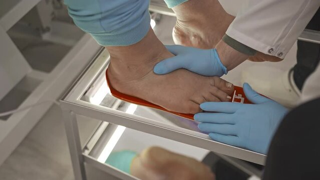 A podiatrist orthopedist tries on a patient with flat feet, sore feet, an orthopedic sole, an insole shoes. Makes examination curvature leg, foot through mirror. Measures leg length with a ruler