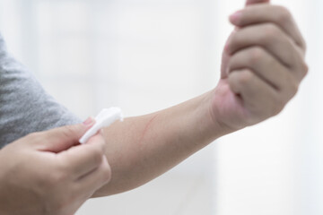 Cat scratch wound on arm of Asia man use medical cotton swab for cleaning and disinfection in First aid concept bleeding wounds