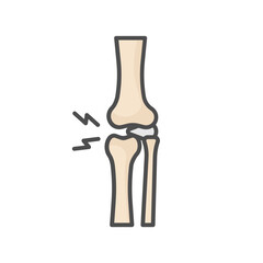 knee arthrosis
