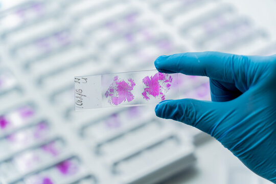 Hand in blue glove holding glass histology slides