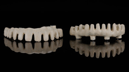 two beams for the prosthesis of the upper and lower jaws made of titanium, filmed on black glass with reflection