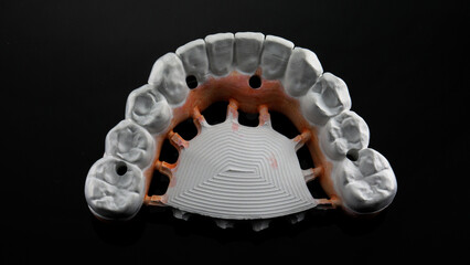 the first stage of a zircon dental prosthesis after milling the machine, a top view of the...