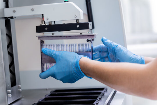 Laboratory assistant works with automatic multi slides stainer at the modern laboratory.
