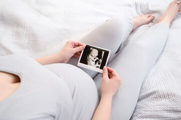 Pregnant woman holding ultrasound image.Young mother waiting of the baby. Concept of motherhood,pregnancy