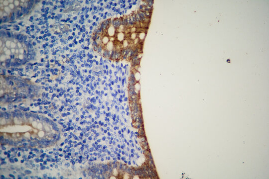 Cecal appendix IHC as seen under a microscope.