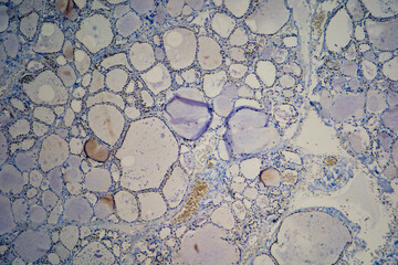 Immunohistochemistry TTF1 of the Thyroid. Control test.