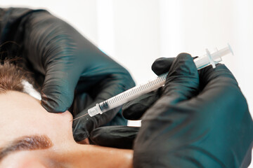 Cosmetologist in black latex gloves makes with syringe injects of a botulinum toxin in the bridge of the nose. Close up. Concept of plastic surgery