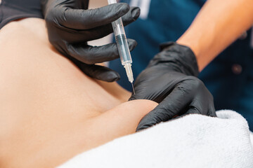 Liposuction. Cosmetologist makes lipolytic injections in female's belly. Close up. Professional aesthetic medicine in a beauty salon