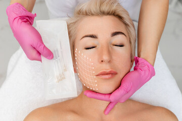 Woman's face with arrows on a cosmetology procedure of thread lifting. Cosmetologist shows the...