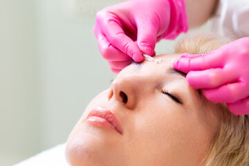 Hardware cosmetology and mesotherapy. Female beautiful face close-up. The cosmetologist's hands apply needles to the client's forehead. Concept of rejuvenation