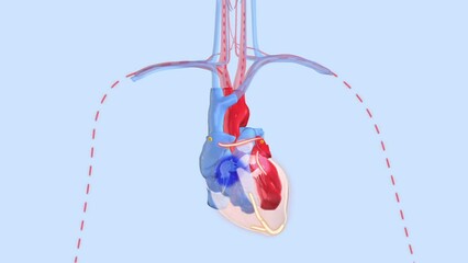 Arrhythmia: Irregular heartbeat and atrial fibrillation of a human heart, 3d animation