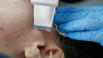 Professional cosmetologist woman doing ultrasonic face cleaning to patient in beauty saloon. Skin...