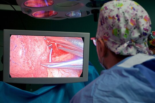 Surgeon Looking At Monitor Performing Laparoscopic Surgery