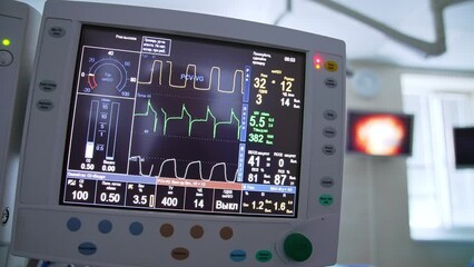 Numbers and lines describing diverse vital parameters of operated patient. Close up with gradual distancing from monitor. - Powered by Adobe