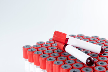 Closeup view of the medical tube