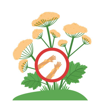 Dangerous hogweed can cause significant damage to skin health. The burn leads to swelling and blisters form on the skin. Flat vector illustration.