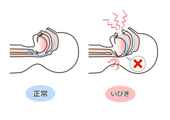 いびきの図解イラスト