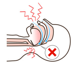 いびきの図解イラスト