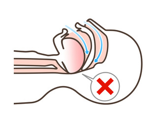 いびきの図解イラスト