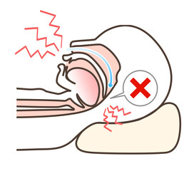 いびきの図解イラスト