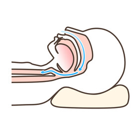 いびきの図解イラスト