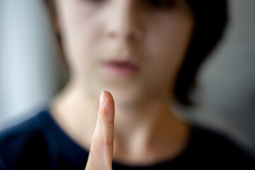 Child, preteen boy, showing wart on his finger, focus on the finger