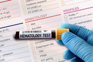 Blood tube test with requisition report for Hematology test. Blood sample tube for analysis of...