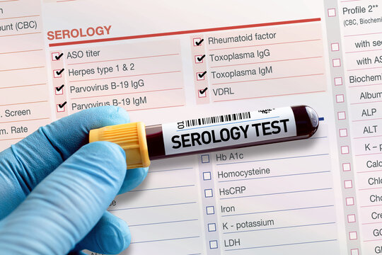 Blood tube test with requisition report for Serology test. Blood sample tube for analysis of Serology in laboratory