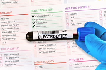 Blood tube test with requisition form for Electrolyte test. Blood sample tube for analysis of Electrolytes profilings in laboratory