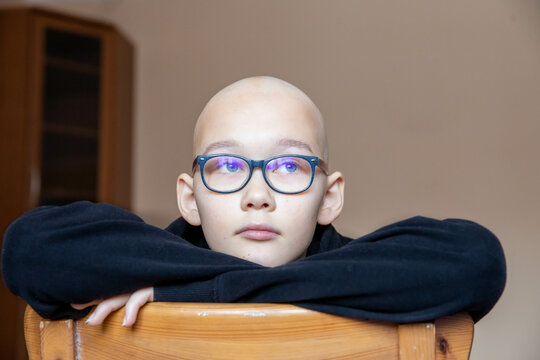 Portrait Of Depression Sad Bald Young Teen Girl With Cancer After Chemotherapy. Wearing Glasses And Black Hoodie, Sitting On The Chair