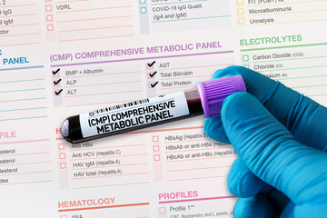 Blood tube test with requisition form for CMP Comprehensive Metabolic Panel testing. Blood sample tube for analysis of CMP Comprehensive Metabolic Panel in laboratory - obrazy, fototapety, plakaty
